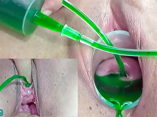 3076 kink porn videos
